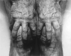 John Coplans  Self Portrait (Hands Spread on Knees)  1985